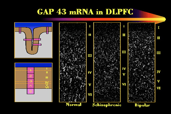 Schizophrenia and mRNA